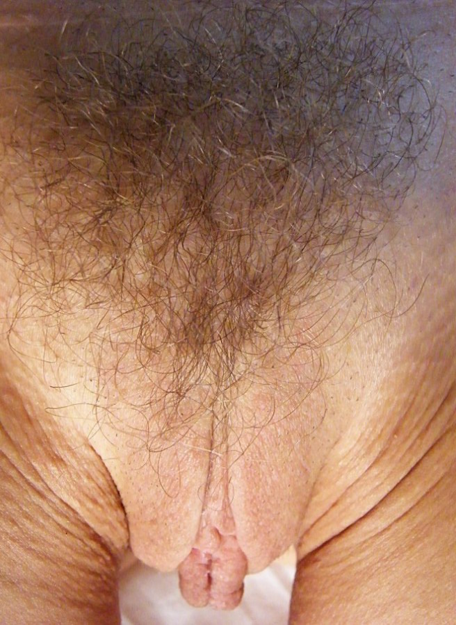 Gratis Foto 9605 Peludas