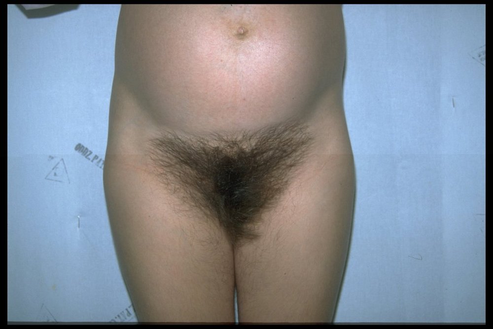 Gratis Foto 14695 Peludas