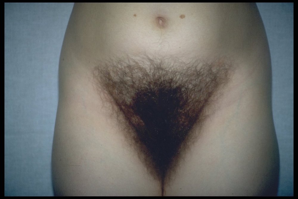 Gratis Foto 13354 Peludas