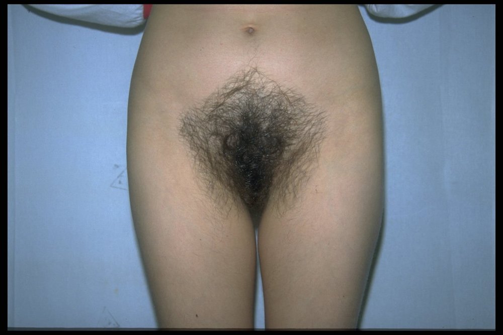 Gratis Foto 8596 Peludas