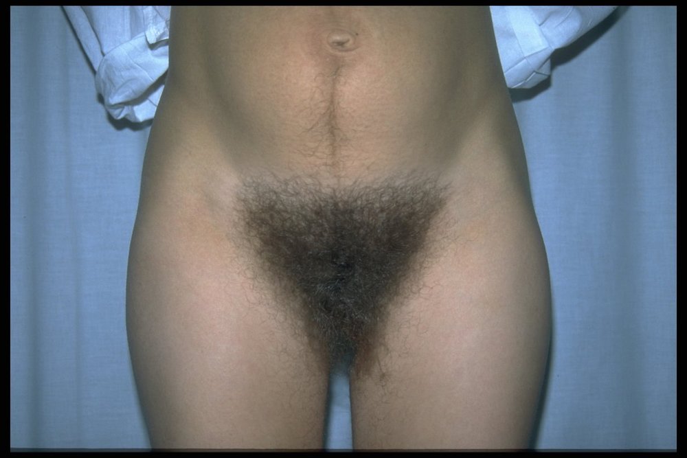 Gratis Foto 4473 Peludas