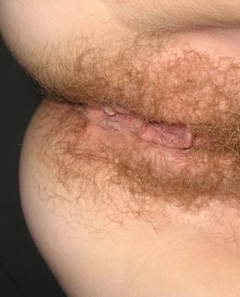 Gratis Foto 5439 Peludas