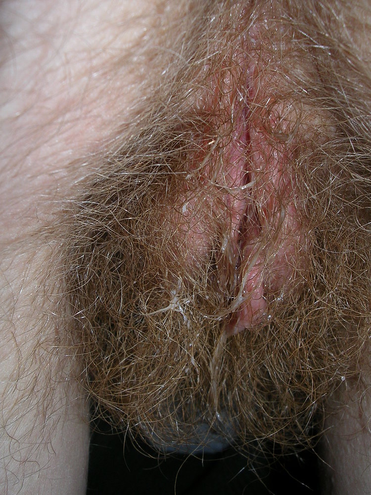 Gratis Foto 6455 Peludas