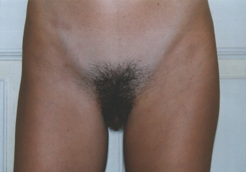 Gratis Foto 8558 Peludas