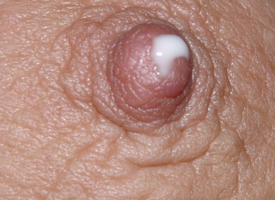 Gratis Foto 14598 Peludas