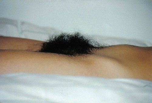 Gratis Foto 1497 Peludas
