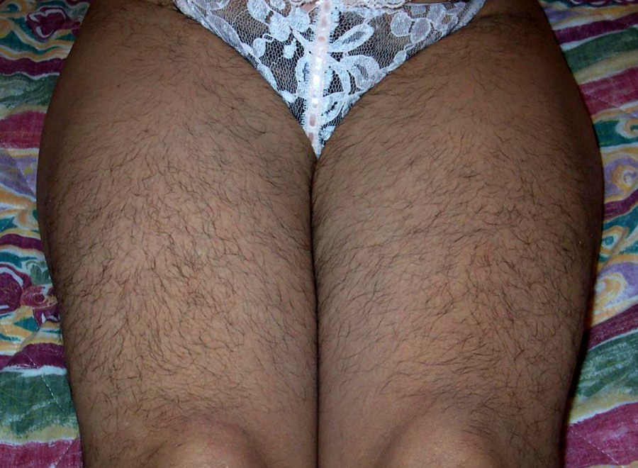 Gratis Foto 11807 Peludas